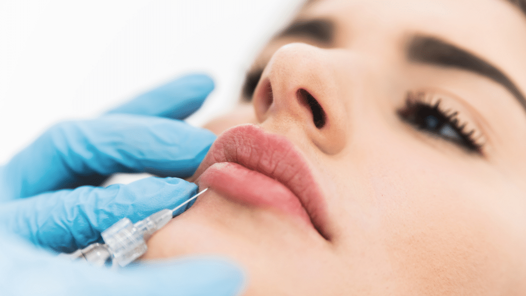 injections-acide-hyaluronique-dentiste-paris